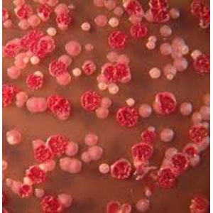 Bệnh Melioidosis