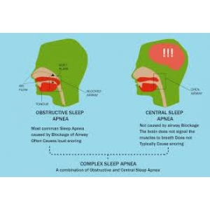 Central Sleep Apnea vs Obstructive Sleep Apnea